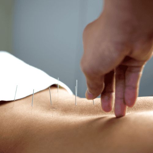 Medical Acupuncture Image for Osteopathy London