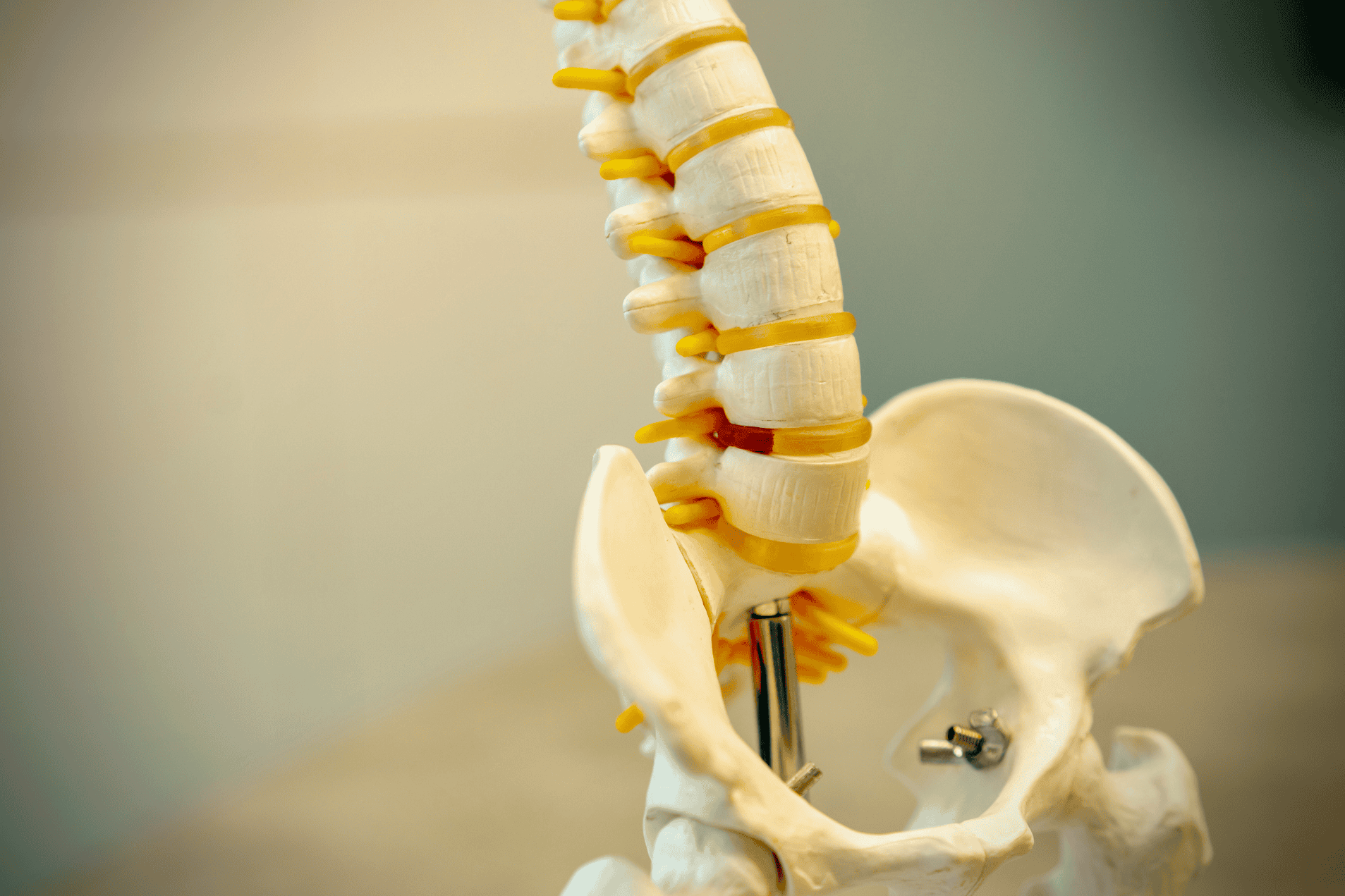 Osteopathy London's Sciatica Spine Image